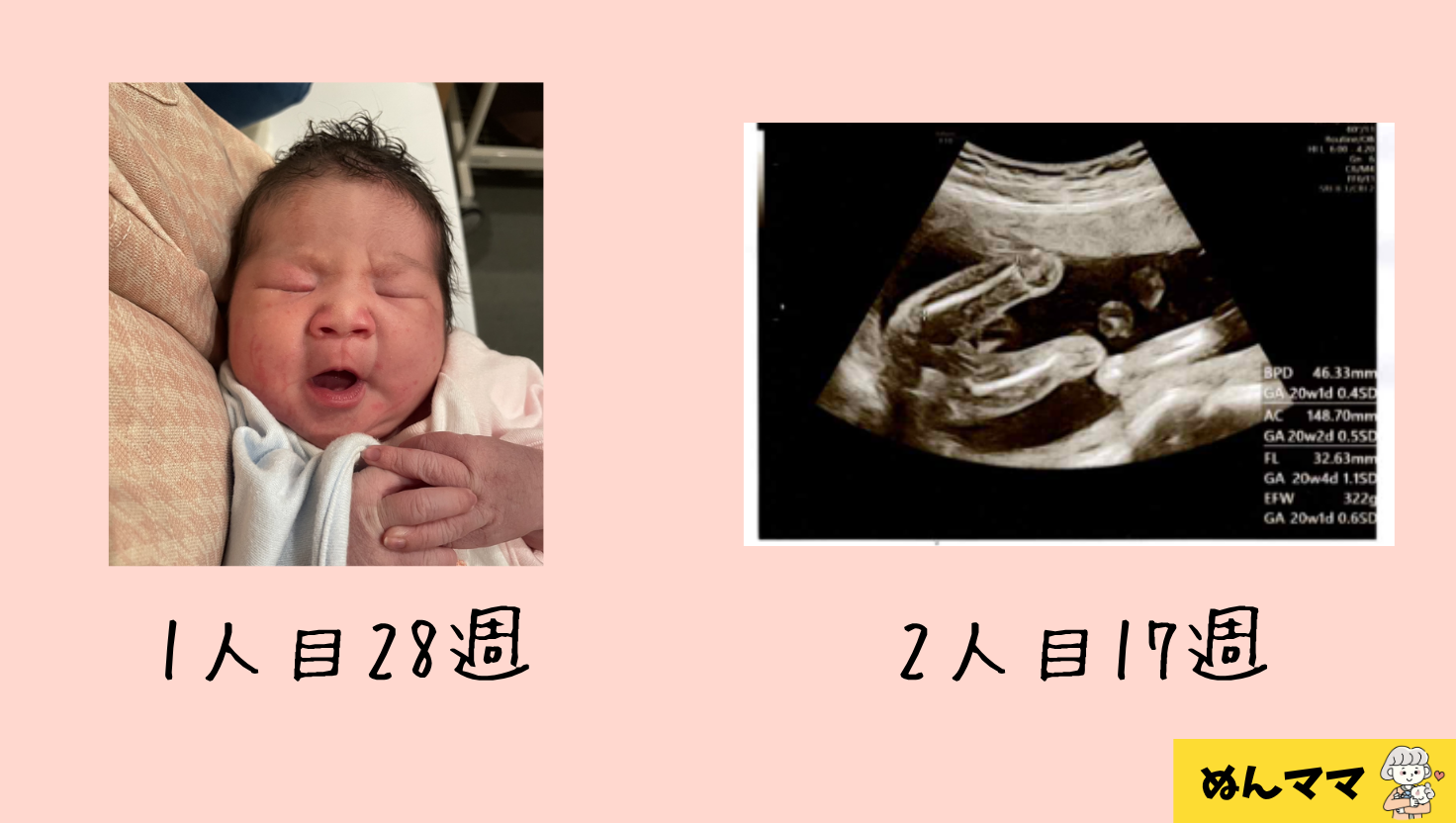 1人目28週 2人目17週