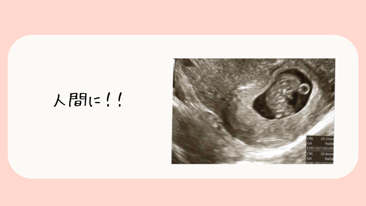 妊娠9週の赤ちゃんの様子