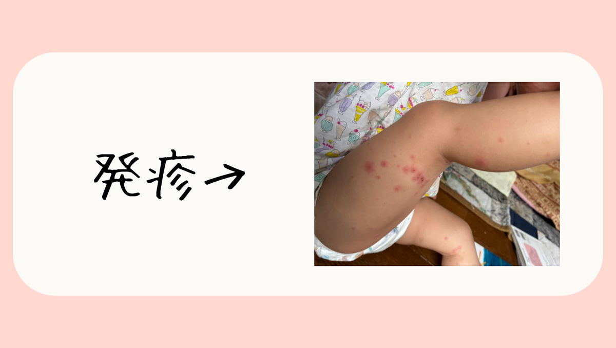 発疹画像