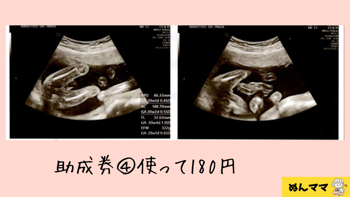 今回のエコー写真