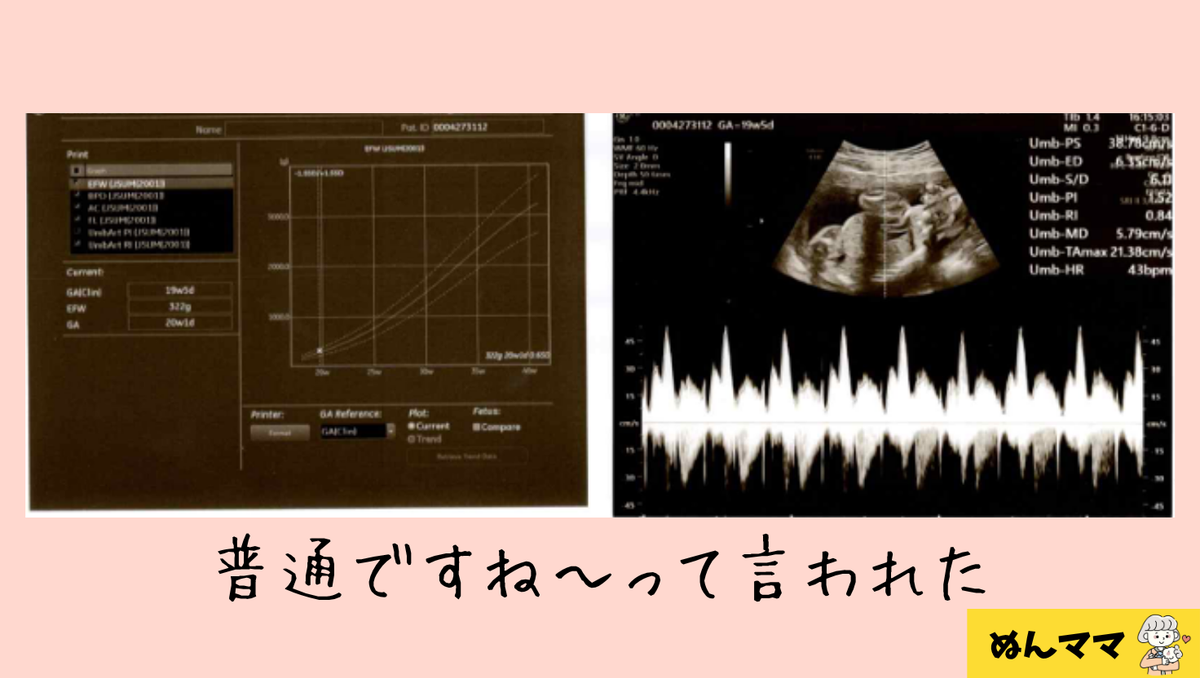 19週の検診内容