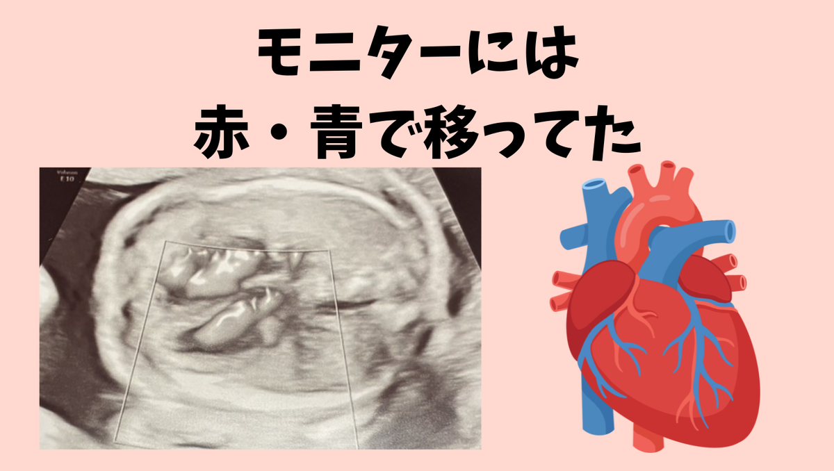 心臓がはっきり!